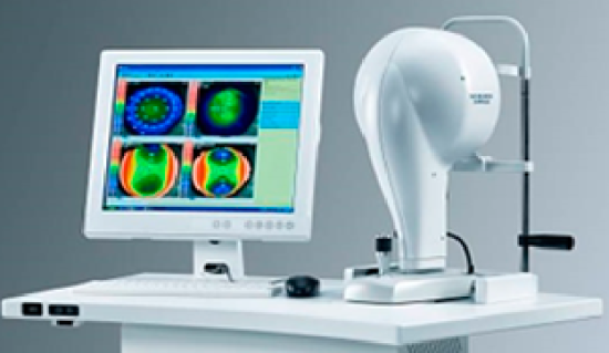 IMG_PATOLOGÍA_CÓRNEA_QUERATOCONO 1