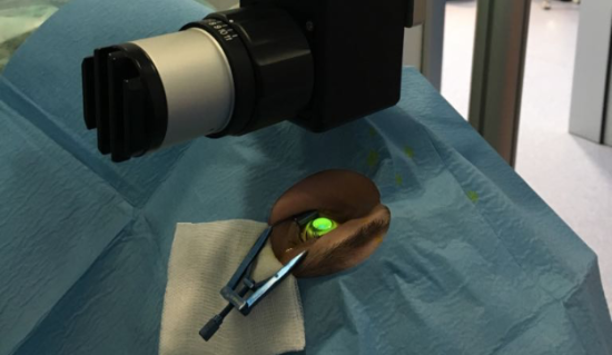 IMG_PATOLOGÍA_CÓRNEA_QUERATOCONO 3